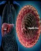 Viêm gan - Biết để sống tốt hơn: Chương 2 - Viêm gan siêu vi A
